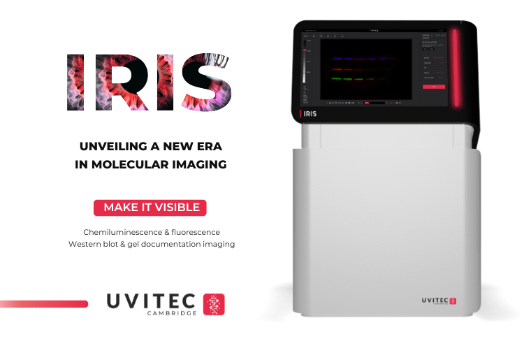 Alliance IRIS molecular-imaging inospectra