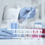 Ratiolab priemonės laboratoriniams skysčiams